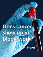 Most cancers don't show up in routine blood work. But there are blood tests that can detect early-stage cancers: The Galleri test: This test can detect over 50 different types of cancer using DNA sequencing to find unique patterns, which may tell your provider whether you have cancer and where it started. Proteomics-based plasma test: A new blood test may show promise for the early detection of 18 different types of cancer, could become a standard for cancer diagnosis.?